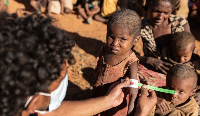 Af Örgütü: Madagaskar'da 1 milyon insan açlıktan ölmekle karşı karşıya, acilen yardım edilmeli - Resim : 1