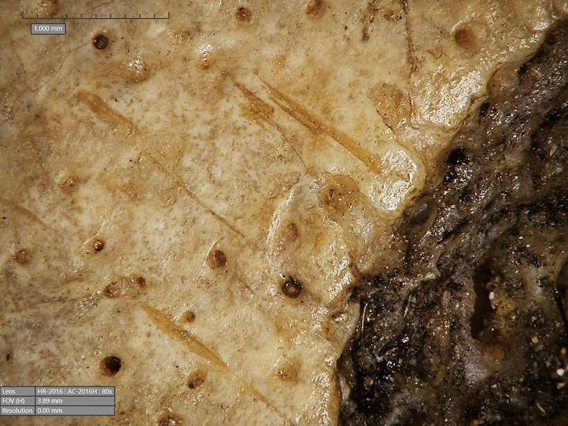 ancient-skull-cancer-3-qoky.jpg