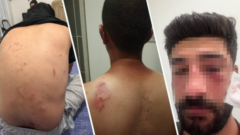 Mersin’de bir aile, Kürtçe konuştukları için saldırıya uğradı: Bir kişi yoğun bakımda